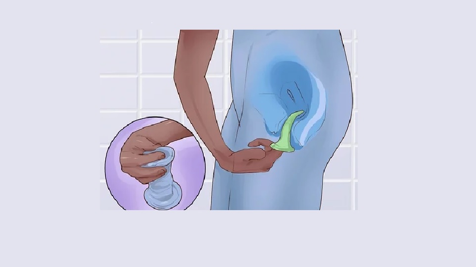 نحوه استفاده از کاندوم زنانه
